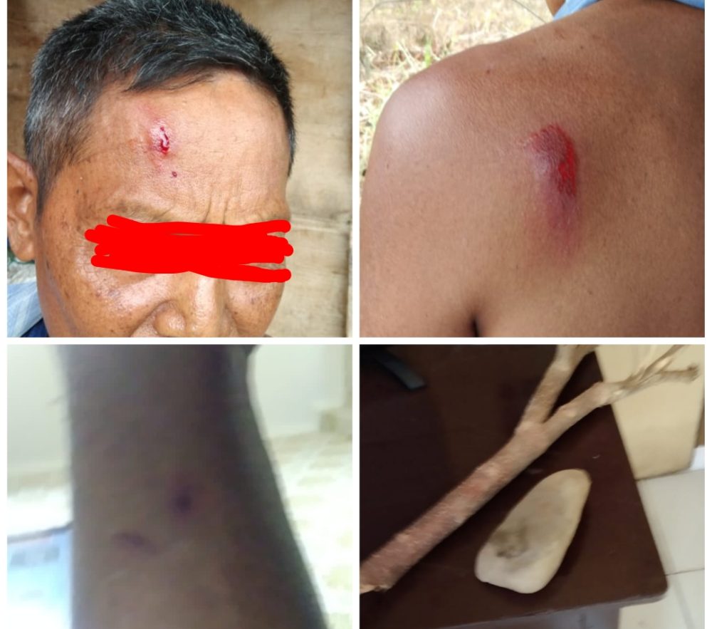 Akibat Lahan Bersengketa, Seorang Lansia di Kolut Dikeroyok Oknum Sekjam Hingga Luka Memar